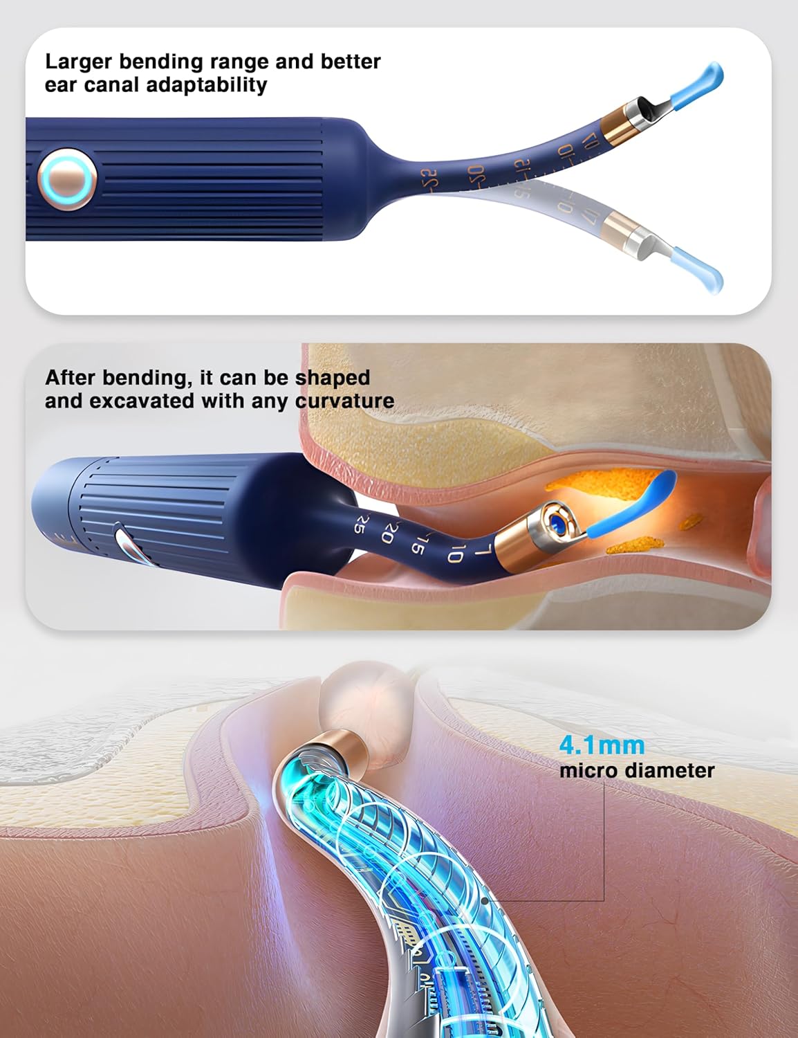 PeekClean™ HD Ear Camera | WiFi Visual Earwax Removal Kit