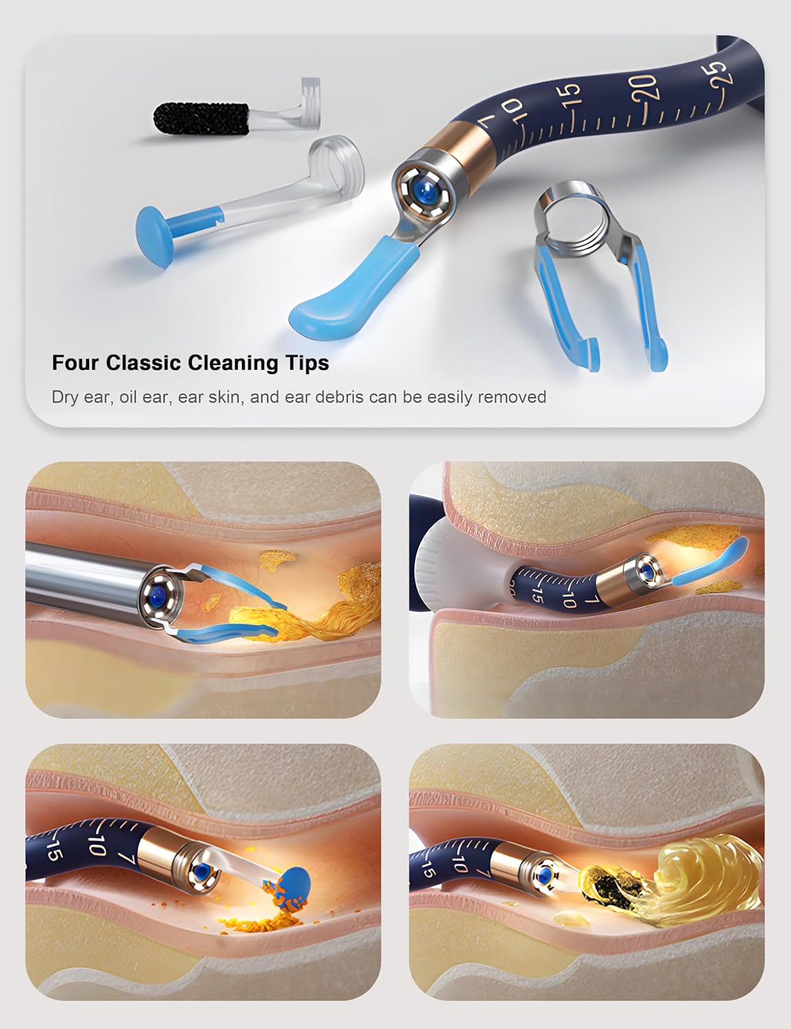 PeekClean™ HD Ear Camera | WiFi Visual Earwax Removal Kit
